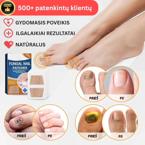 Gydomieji pleistrai nagams