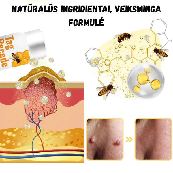 Efektyvus gydomasis purškalas odos netobulumams