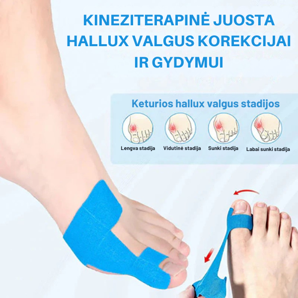 Kineziterapinė juosta hallux valgus korekcijai ir gydymui