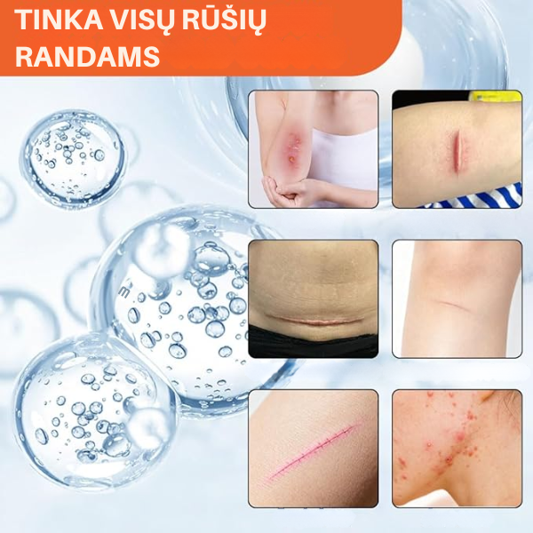Pažangi ir veiksminga priemonė randams šalinti